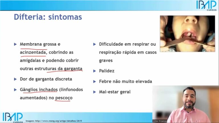 Os Especialistas em Difteria: Diagnóstico e Tratamento
