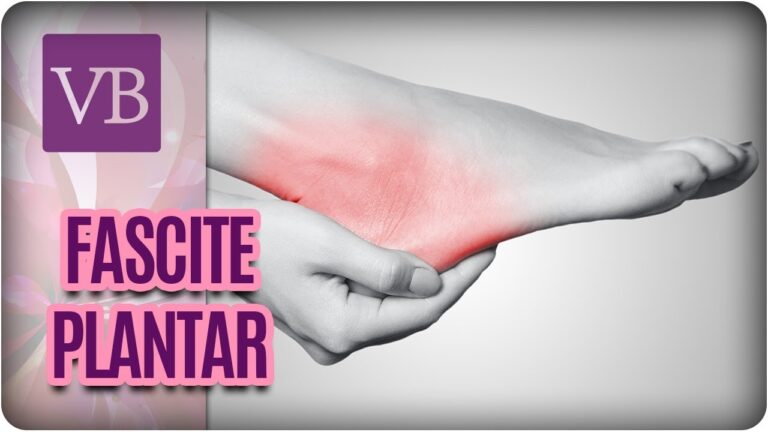 Como lidar com a fascite plantar incapacitante