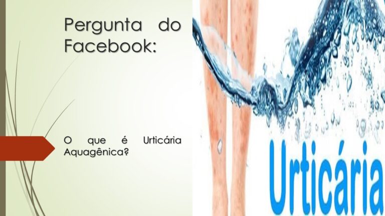 Tratamento Eficaz para Urticária Aquagênica