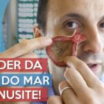 Como Calcular a Dose de Predsim em Gotas