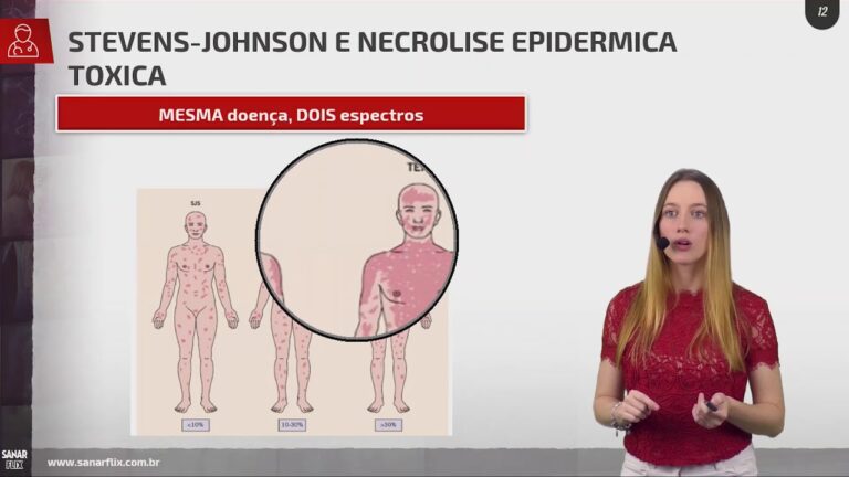 Farmacodermia: O que s&atilde;o e Como Identificar Fotos