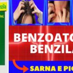 Benefícios da Máquina de Ressonância Aberta na Saúde