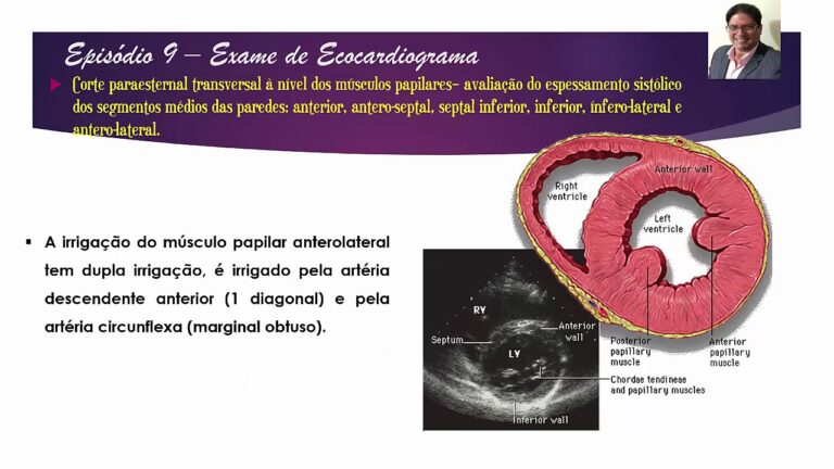 Papilares Musculares: Função e Importância no Coração