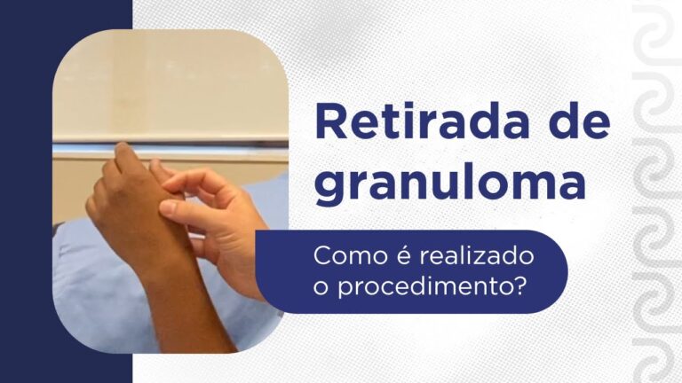 Custo da cirurgia de granuloma: o que saber