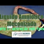 Guia de Sintomas da Candid&iacute;ase Intestinal