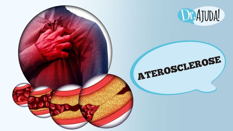 Diagn&oacute;stico da Aterosclerose: M&eacute;todos e Import&acirc;ncia