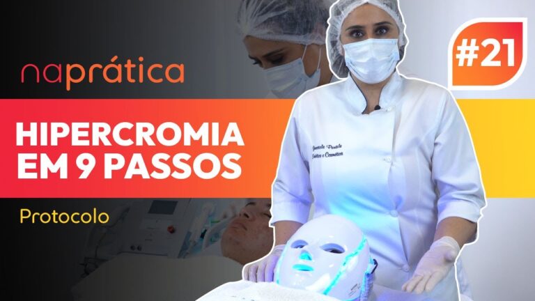 Manchas Hipercr&ocirc;micas na Pele: Causas e Tratamentos