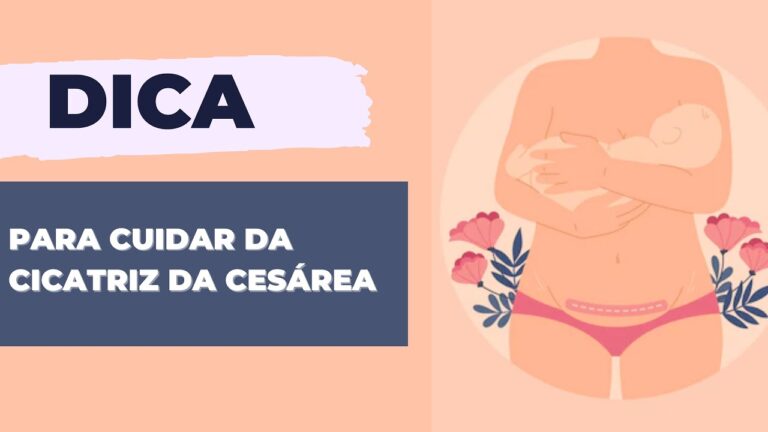 Marcas da Cesárea: Como Cuidar da Cicatriz