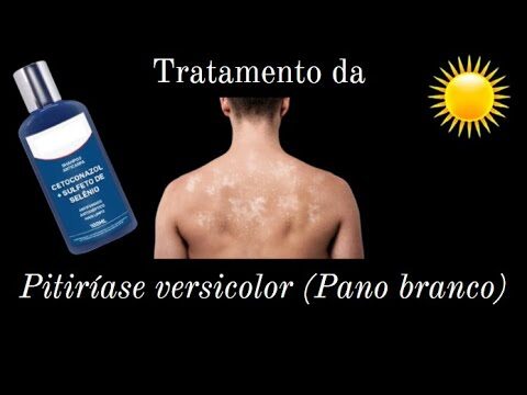 Tratamento eficaz para pitir&iacute;ase versicolor