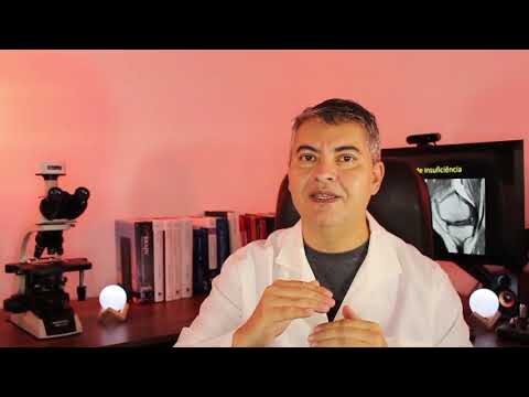 Fratura por Insuficiência: Causas, Sintomas e Tratamentos