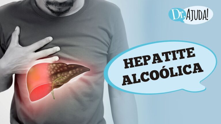 Hepatite Alcoólica: Causas e Sintomas