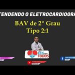 Aumento de Escavação: Estratégias e Benefícios
