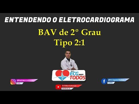 Entendendo o Bloqueio Atrioventricular 2:1
