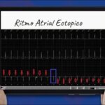 Gatos picados por abelha: O que fazer em caso de emergência
