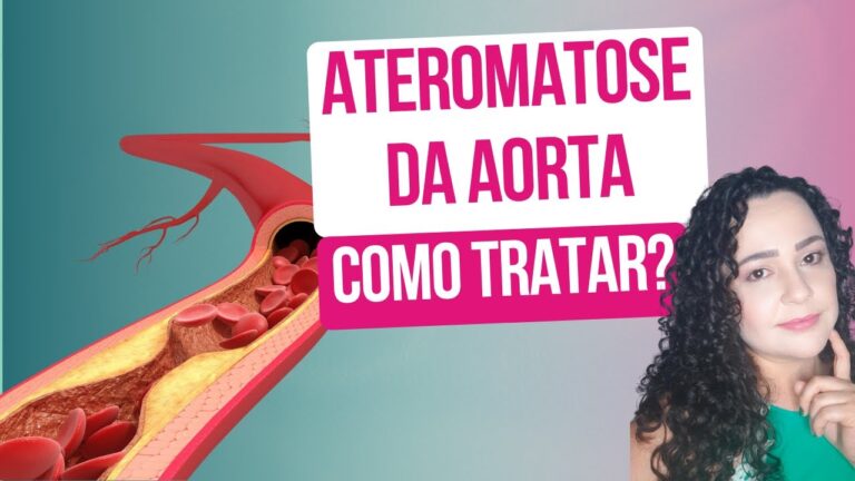 Tratamento da Ateromatose Aórtica: Estratégias Eficazes