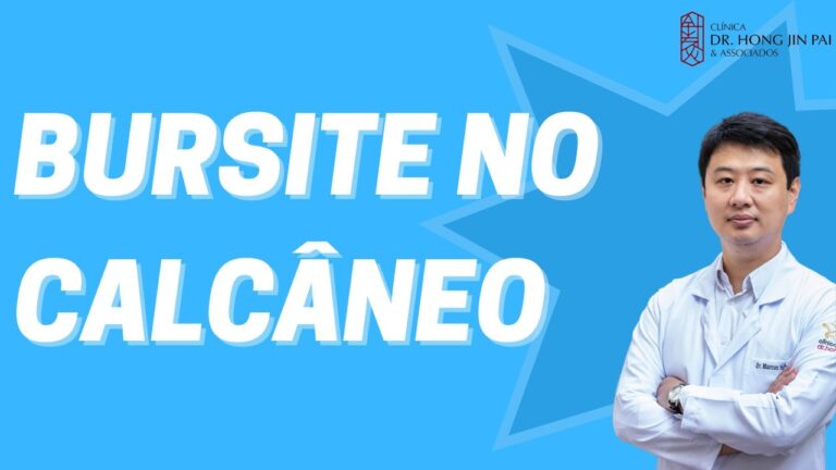 Bursite Retrocalcânea: Causas, Sintomas e Tratamento