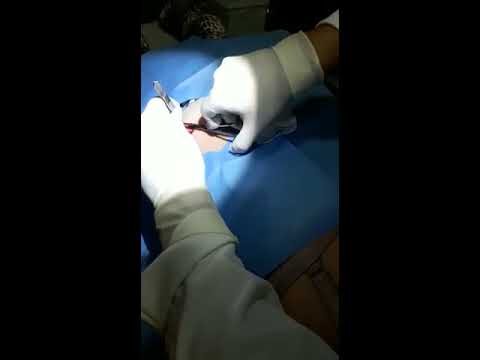 Guia para uma Incis&atilde;o El&iacute;ptica Eficiente