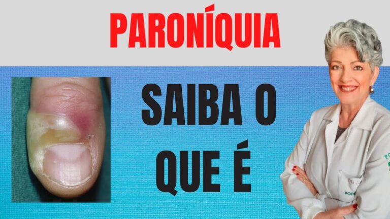 Paroníquia em bebês: Causas e Tratamentos