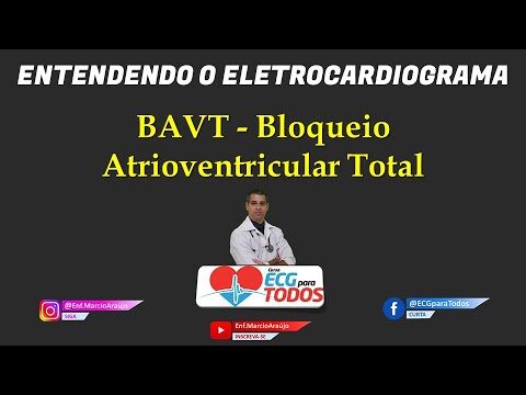 Maximizando o Valor do Bav Total