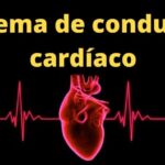 N&oacute;dulo n&atilde;o calcificado no pulm&atilde;o: diagn&oacute;stico e tratamento