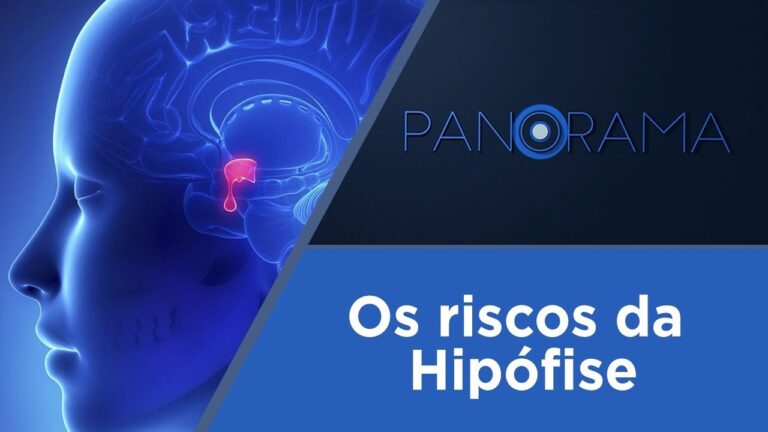 Tudo sobre Adenoma da Gl&acirc;ndula Pituit&aacute;ria