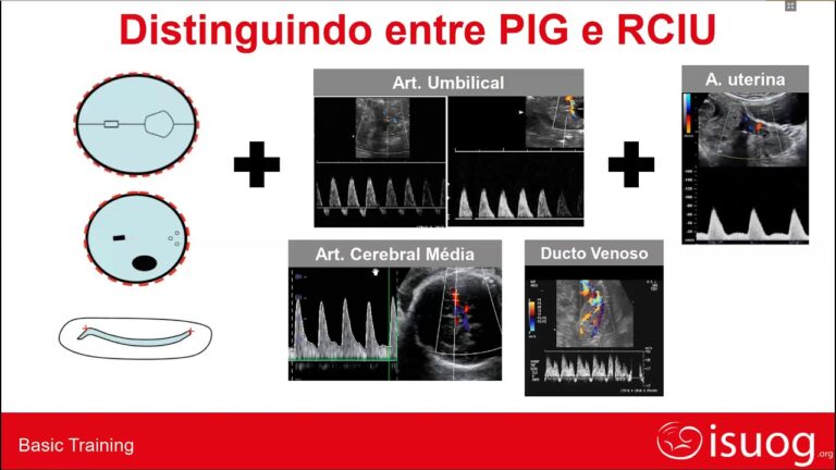 Importância da Circunferência Craniana Fetal na Avaliação Pré-Natal