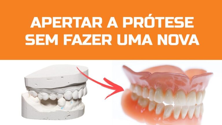 Como Ajustar Sua Prótese Dentária: Dicas e Orientações