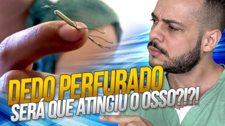Como Aliviar o Bloqueio Troncular no Dedo: Guia Completo
