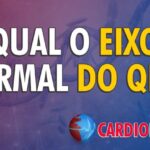 Pr&aacute;ticas Eficientes de Atividades para Defici&ecirc;ncia Intelectual