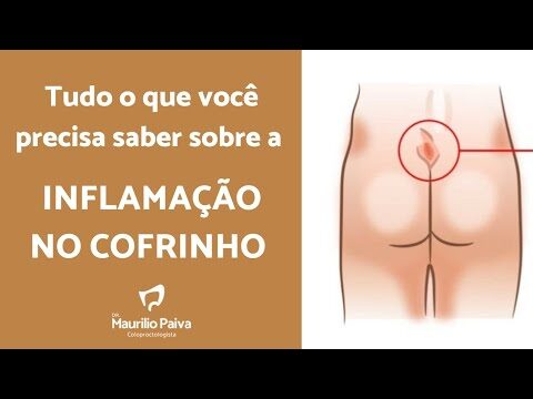 Diagnóstico e Tratamento da Fissura na Fenda Interglútea