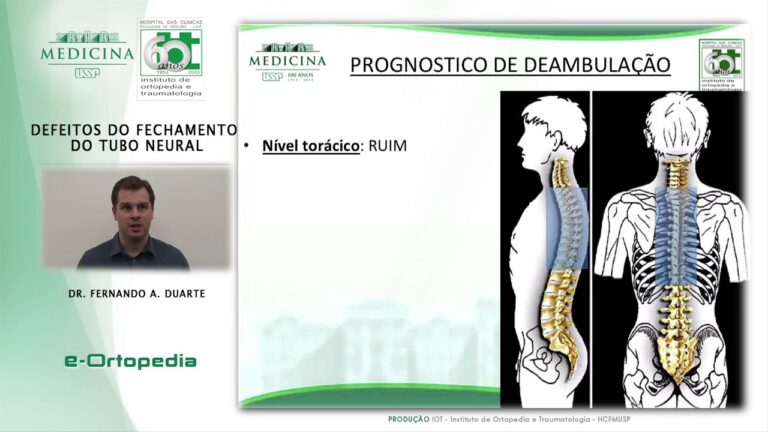Malformação do tubo neural: Causas e Tratamentos