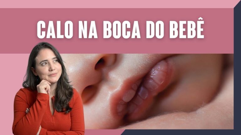 Causas e Tratamentos para Calos na Boca