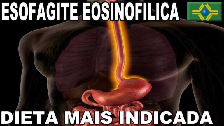 Dieta para Esofagite Eosinofílica: Guia Completo