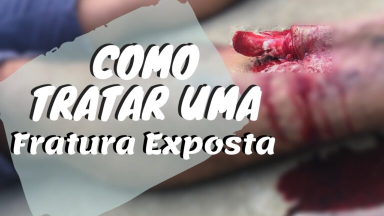 Fraturas Expostas: Primeiros Socorros Essenciais