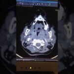 Materiais ideais para curativo pós-cirúrgico