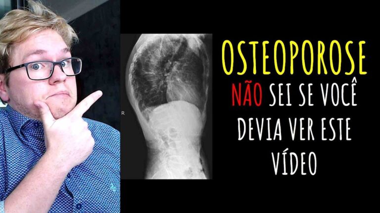 Osteoporose no Raio X: Diagnóstico e Tratamento