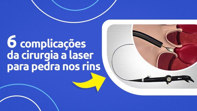 Riscos da Cirurgia a Laser para Pedra nos Rins