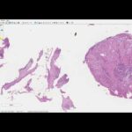 Materiais ideais para curativo pós-cirúrgico