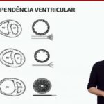 Adenomiose: Entenda o Sangramento Intenso