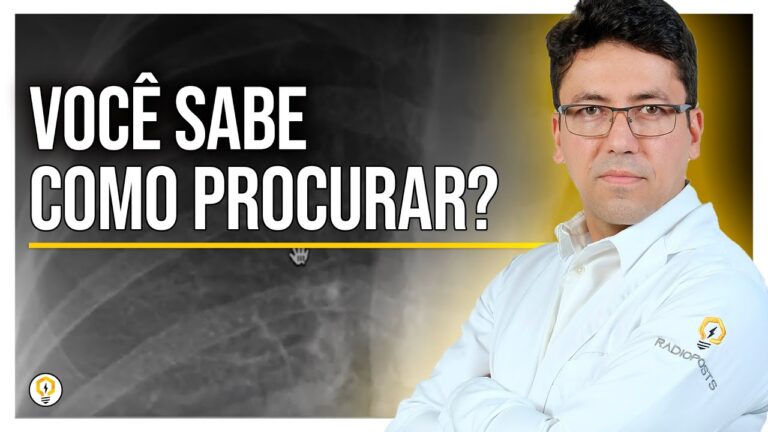 Raio X no Diagnóstico de Pneumotórax