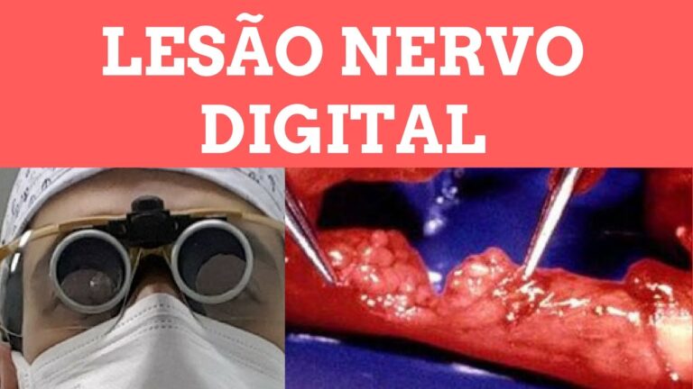 Neurorrafia: Entenda o Procedimento e Suas Aplicações