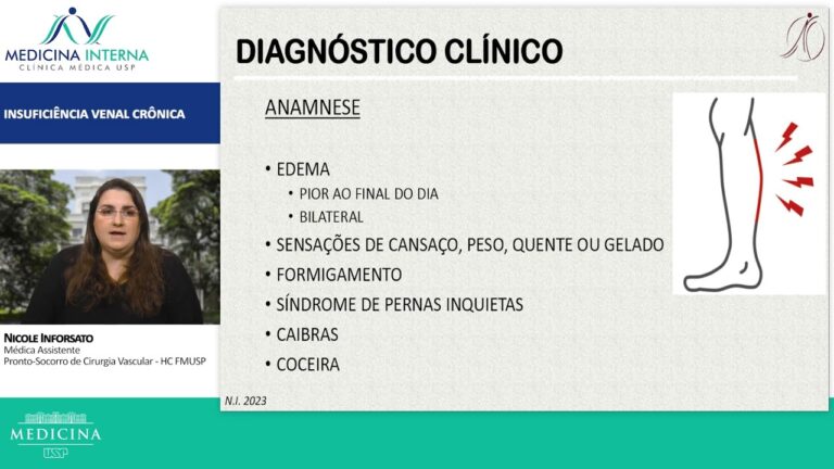 Tratamento Eficaz da Insuficiência Venosa Crônica Periférica