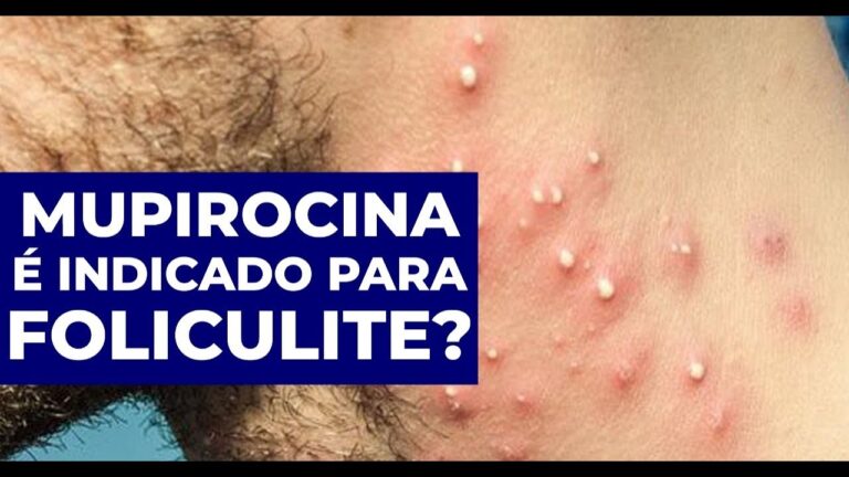 Mupirocina: Indicações e Usos