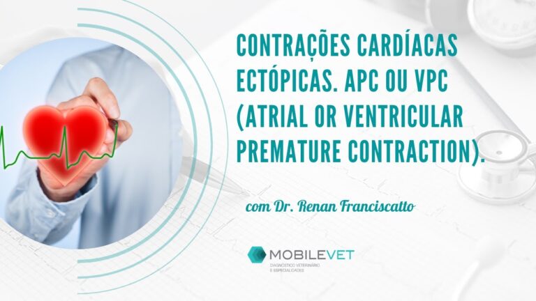 Entendendo a Contração Atrial Prematura: Causas e Implicações
