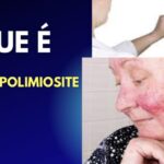 Marcapasso Provisorio: Indicações e Cuidados Essenciais