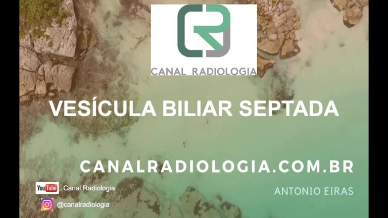 Vesícula Biliar Septada: Causas, Sintomas e Tratamento