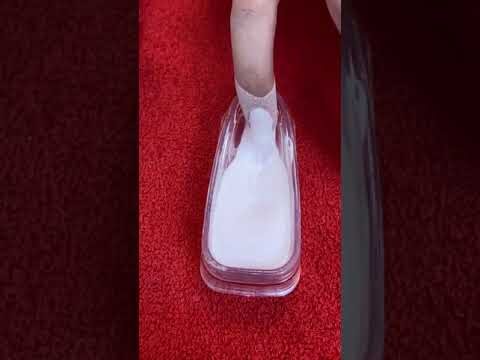 Como Evitar e Tratar L&aacute;bios Rachados