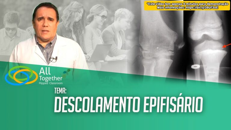 Epífise de Crescimento: O Que Você Precisa Saber