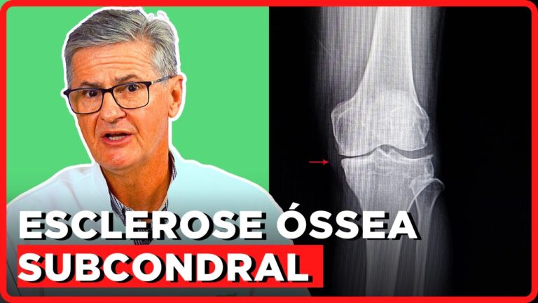 Entendendo a Esclerose Marginal: Causas e Tratamentos