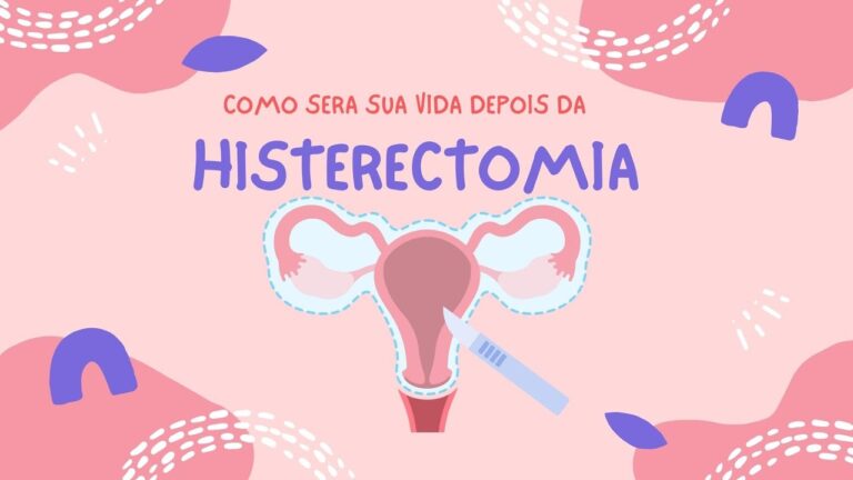 Colo do Útero Após Histerectomia: O Que Você Precisa Saber ...